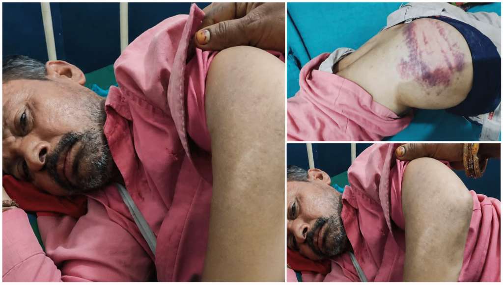 सर्लाही प्रहरीको ज्यादती: उजुरीपछि प्रहरी कार्यालय पुगेका अभिभावक निर्घात कुटिए